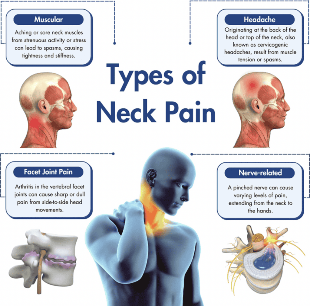 Illustration showing different types of neck pain including muscular, headache, facet joint, and ner.
