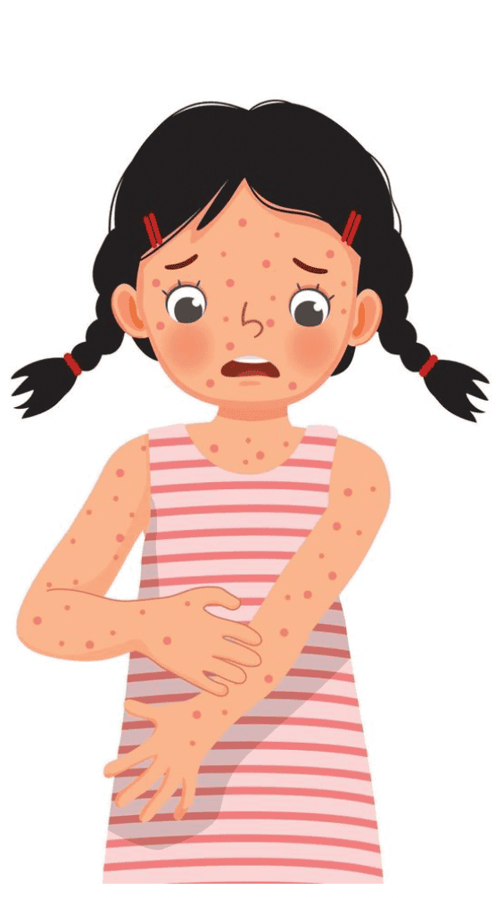 Child with skin allergy and rashes, holding her arm in discomfort.
